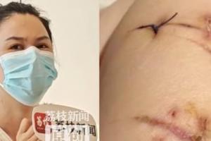 Cô gái bị đâm 22 nhát dao thoát chết nhờ từng nâng cấp vòng 1