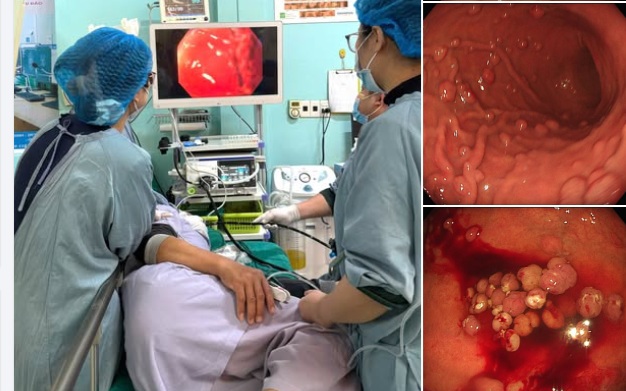 Người đàn ông từng mắc viêm dạ dày đi khám phát hiện cùng lúc 5 bệnh từ dấu hiệu nhiều người Việt bỏ qua